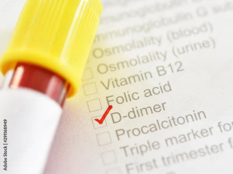 D-Dimer Test Overview and Procedures